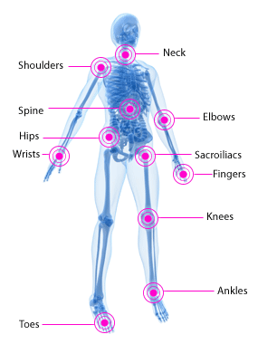 Joints affected in psoriatic arthritis.