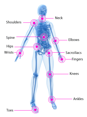 is sulfasalazine used to treat psoriatic arthritis