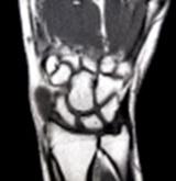 IRM d'un poignet humain